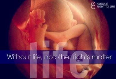 no-rights-abortion